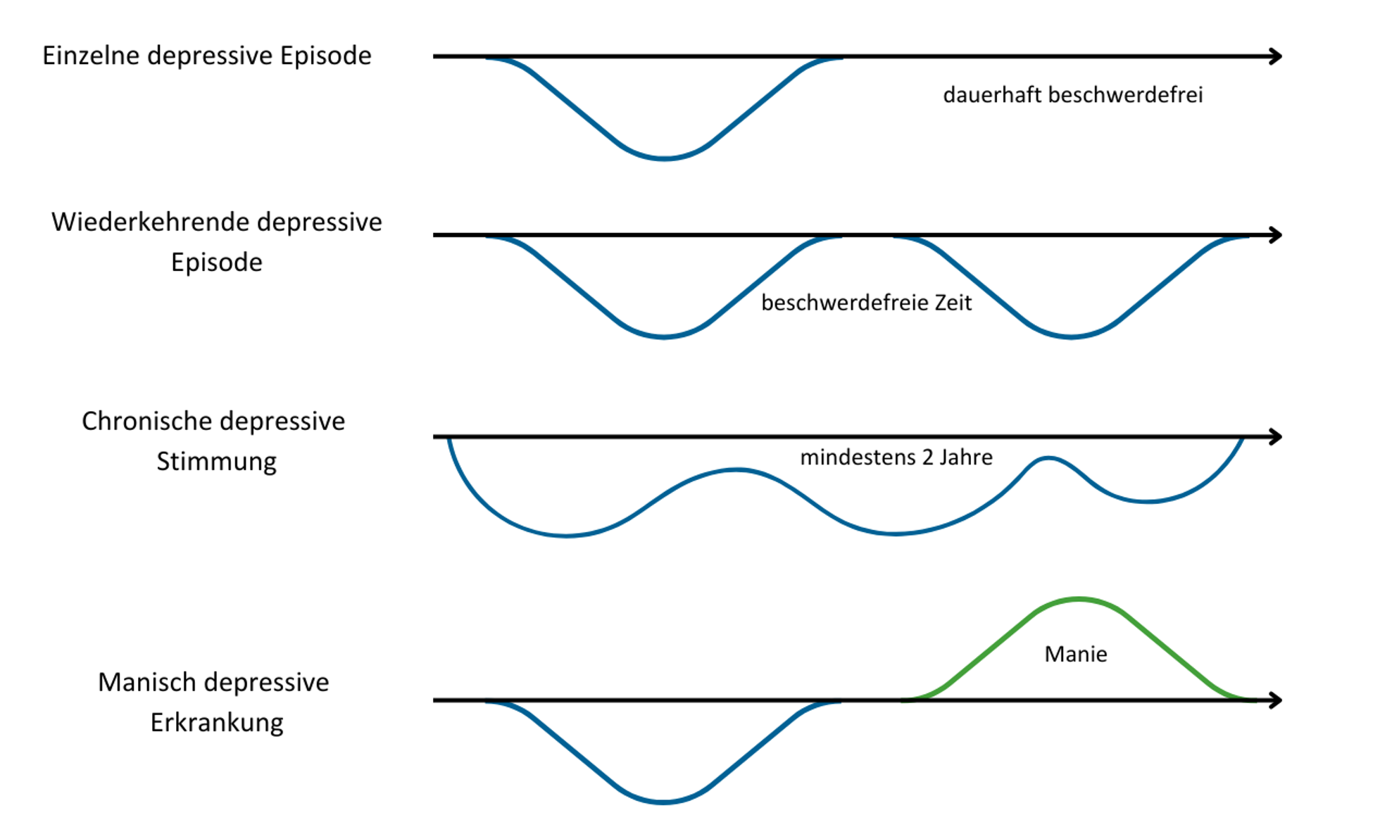 Grafische Darstellung verschiedener Verläufe einer Depression