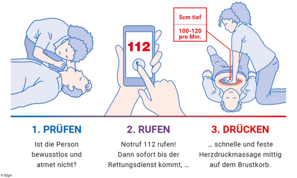 Grafiken zu Schritten zur Wiederbelebung bei Herzstillstand